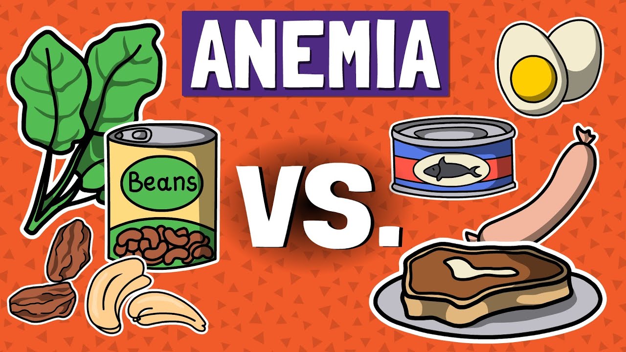 Heme vs. Non-Heme Iron for ANEMIA | How To Avoid IRON TOXICITY | Nerdtritionists Heme vs. Non-Heme Iron for ANEMIA | How To Avoid IRON TOXICITY | Nerdtritionists