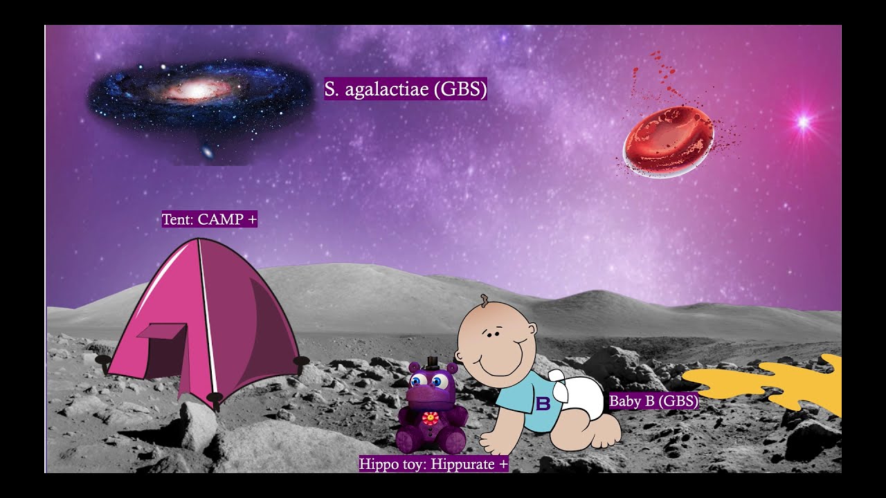 Short Story: Group B Beta-Hemolytic Streptococci (GBS) Short Story: Group B Beta-Hemolytic Streptococci (GBS)