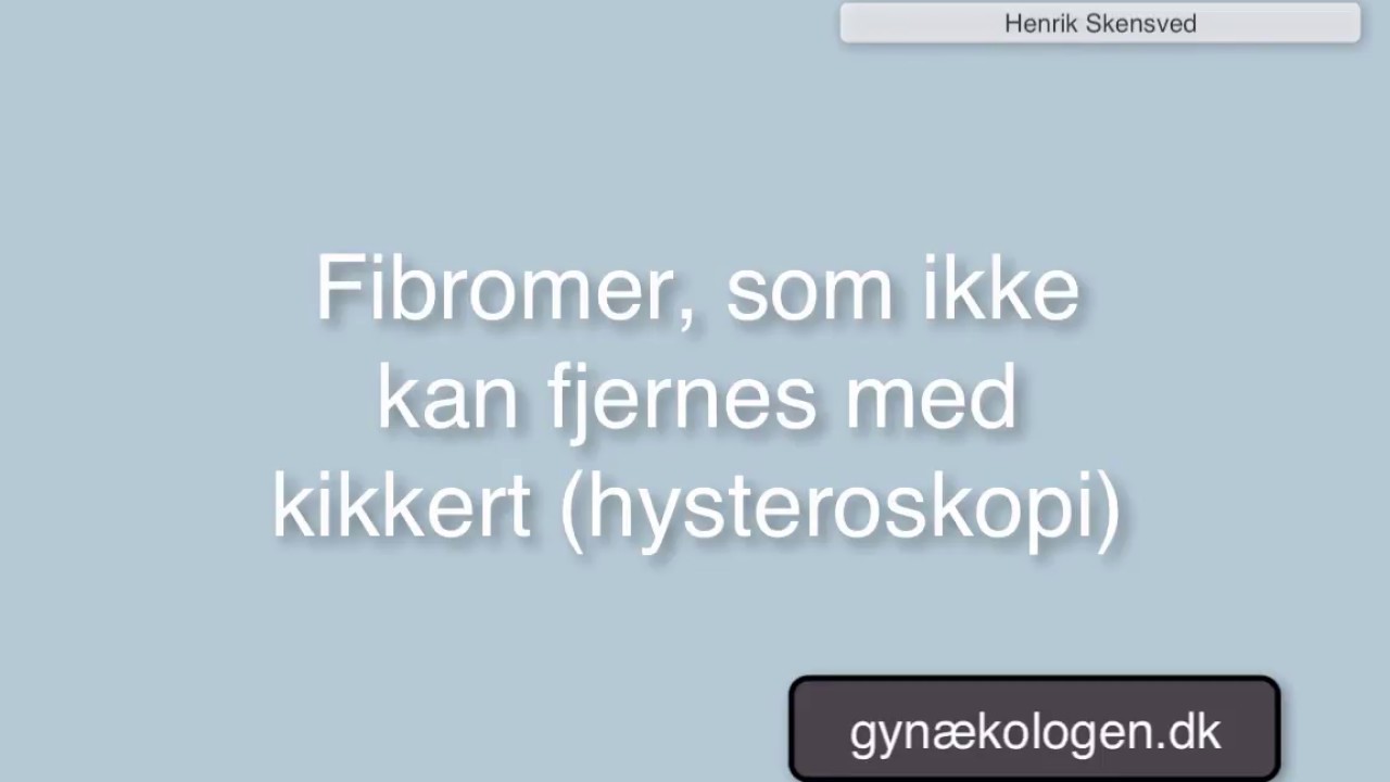 Fibromer som ikke kan fjernes med kikkert Fibromer som ikke kan fjernes med kikkert