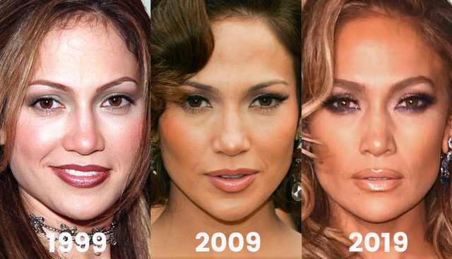 Plastic Surgeon'S Jaw-Dropping Photos Reveal What Jennifer Lopez, Jennifer  Aniston And Tess Daly Would Look Like If They Aged Like 'Normal People' –  The Sun | The Sun
