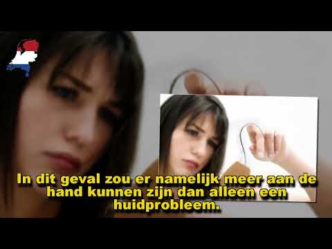 Redenen om een afspraak te maken bij de dermatoloog Redenen om een afspraak te maken bij de dermatoloog