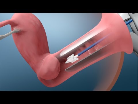 Pap and HPV Testing | Nucleus Health Pap and HPV Testing | Nucleus Health